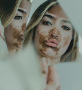 Quand la peau parle… et que le mental compte aussi